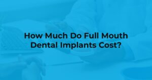 Full mouth dental implant cost at Yen Oral Surgery in California