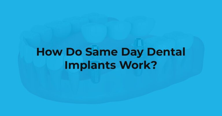 How Do Same Day Dental Implants Work? at Yen Oral Surgery